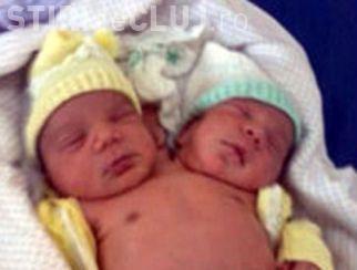 Одна жизнь на двоих. История сиамских близнецов в фотографиях - фото 3
