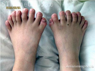 Un copil din China are 31 de degete - Galerie FOTO