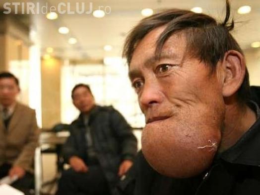 Unui chinez ii "explodeaza" barba - Imagini socante