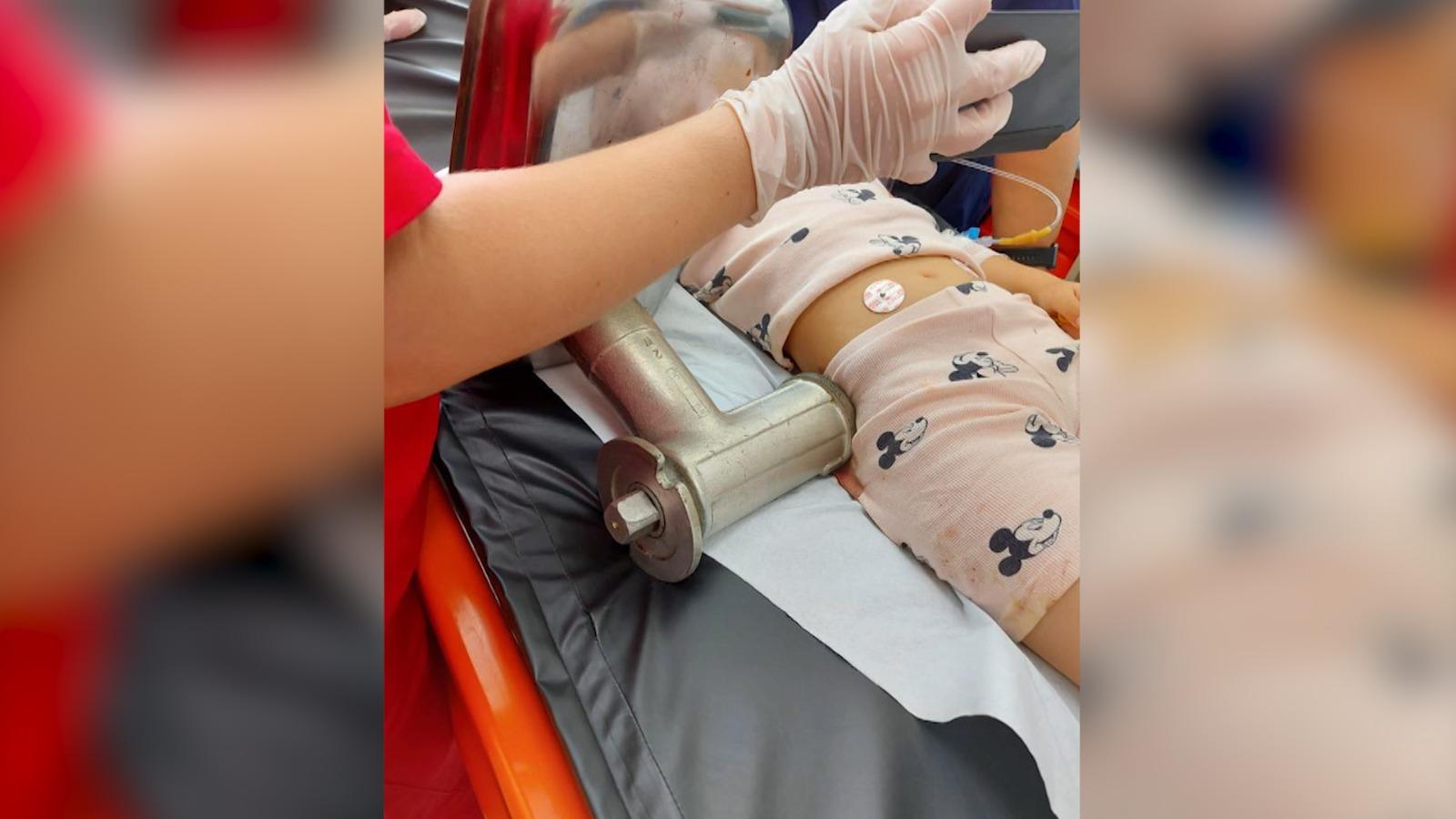 fetita cu mana rupta 1.jpg