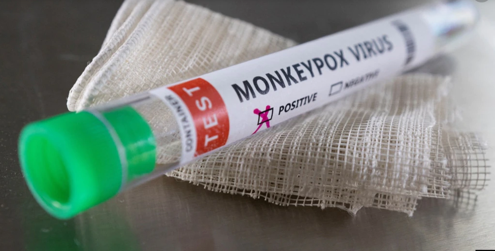 A fost diagnosticat al treilea caz de variola maimuței în Cluj. Doar în ultima săptămână au fost descoperite nouă cazuri