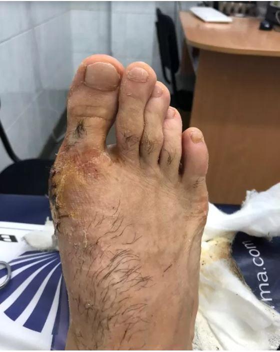 poza monturi after.JPG