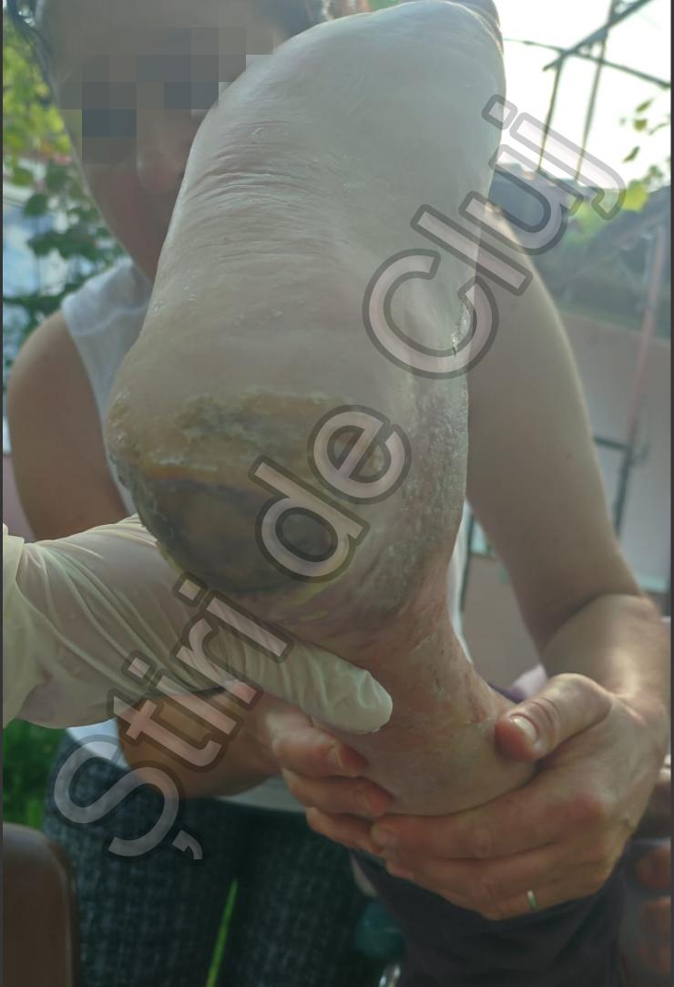 pers cu handicap 5 picior .png