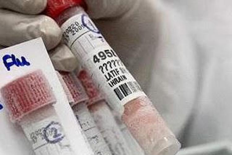 Testul de depistare a gripei porcine se cumpara la Cluj din farmaciile Dona