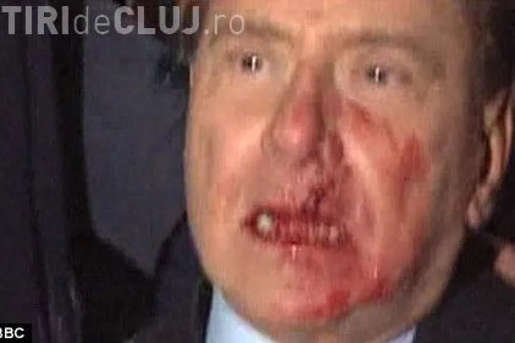 Berlusconi, lovit cu pumnul in fata