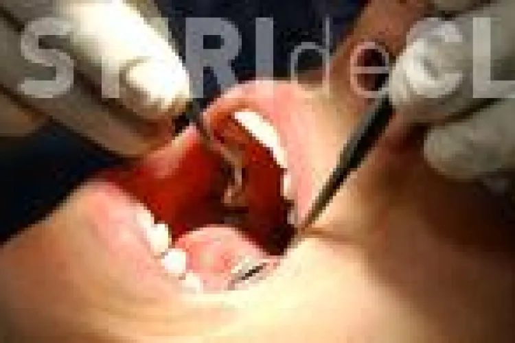 Statul da pentru medicina dentara 70 de bani pe an pe cap de locuitor 