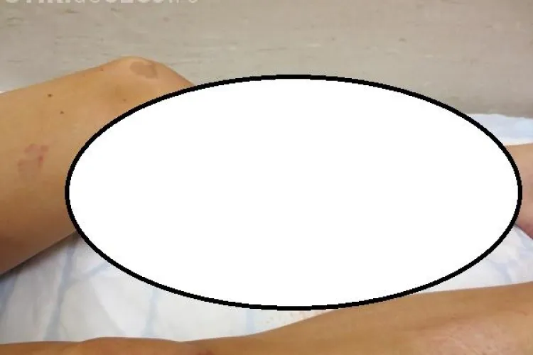 O femeie reclamă că a fost atacată și mușcată de o haită de câini în Mănăștur / UPDATE: Cazul pare o FĂCĂTURĂ ORDINARĂ