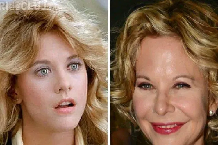 Meg Ryan este desfigurată de atâtea operații estetice