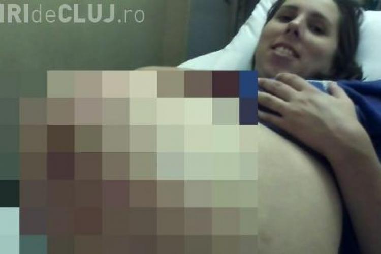 Cum arată burta acestei femei însărcinate. Medicii s-au CRUCIT - FOTO