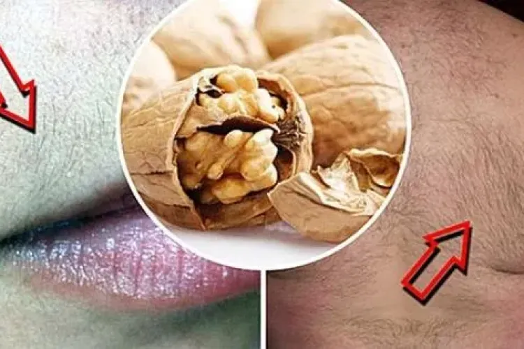 Și-a pus coji de nuca arse pe zonele cu păr. Ce s-a întâmplat e incredibil