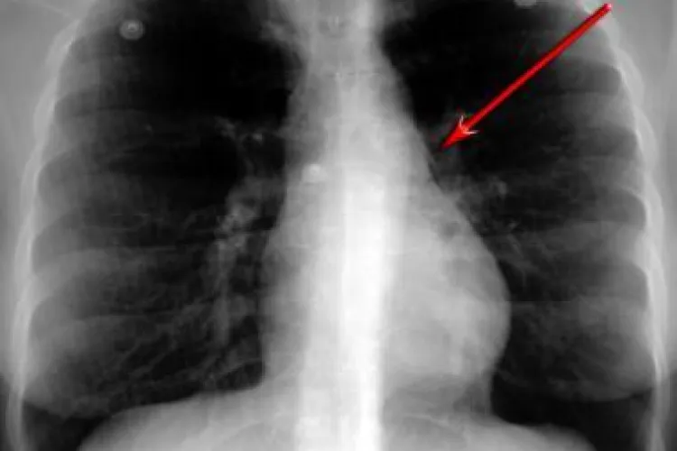 Băiețel de 2 ani, în stop respirator la Spitalul de Copii! Părinții s-au șocat de ce avea în plămâni