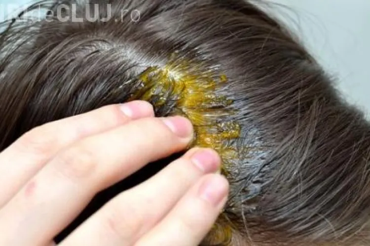 Si-a pus suc de usturoi în păr, iar rezultatul a fost incredibil - FOTO