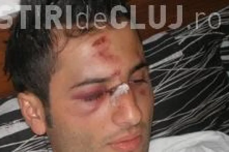 Vezi cum arata chelnerul batut de Adrian Mutu! FOTO