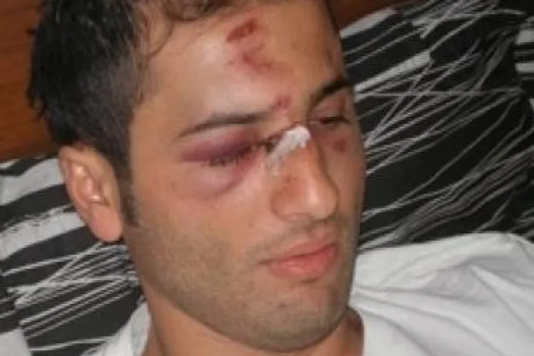 Ospatarul batut de Adrian Mutu rupe tacerea: "M-a izbit fara mila cu piciorul in fata pentru 160 de euro!"