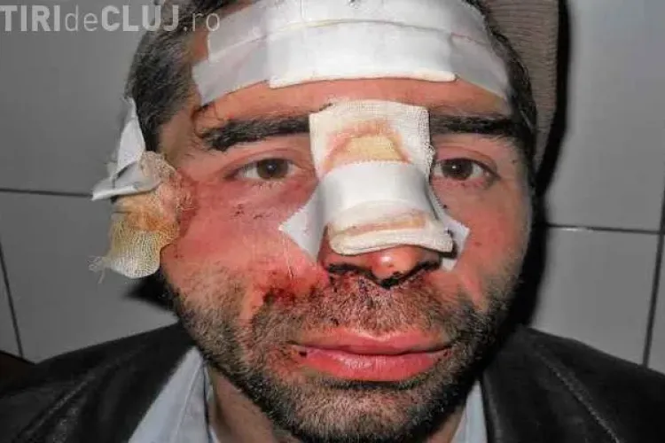 Clujean rupt în bătaie, după ce a făcut o faptă BUNĂ - FOTO