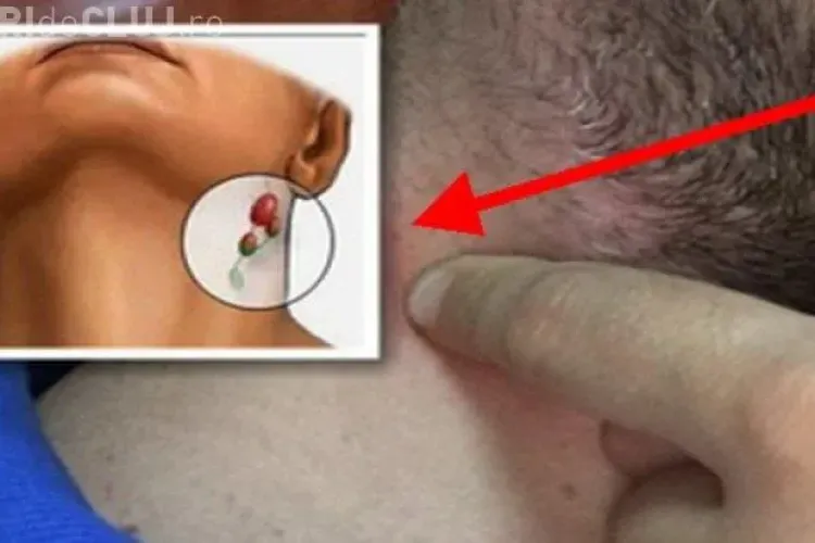 Ține APĂSAT aceste puncte de pe corpul tău pentru a afla dacă ai cancer sau bacterii