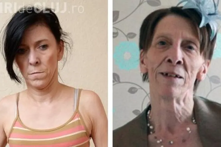 O adolescentă cu chip de bătrână s-a operat pentru a scăpa de batjocura tuturor! Intervenția a costat 60.000 de euro 