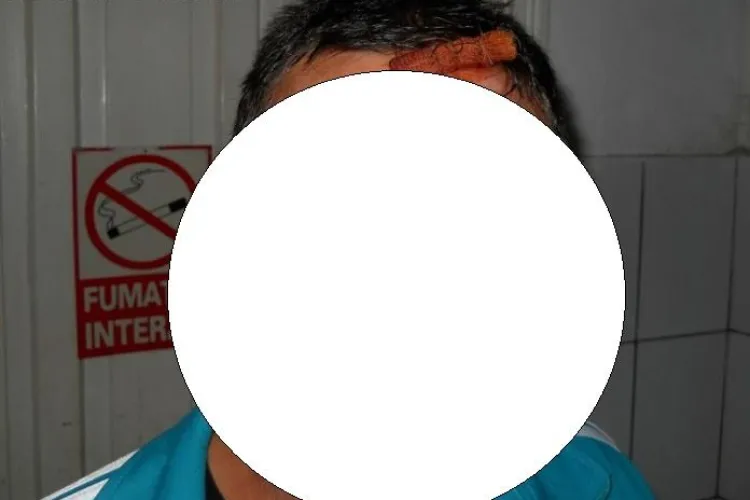 Clujean RUPT în bătaie pentru că nu a cedat scaunul la bar - FOTO