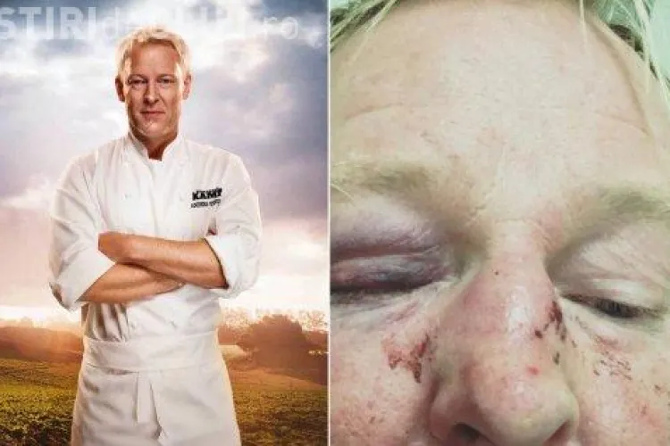 Prezentator TV, bătut crunt pentru că seamănă cu Donald Trump