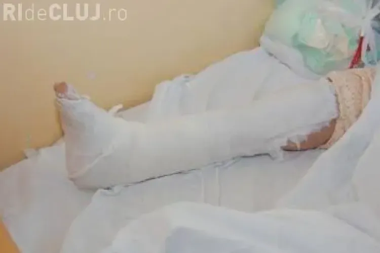 O clujeancă și-a rupt piciorul când cobora din autobuz. Gropile fac victime