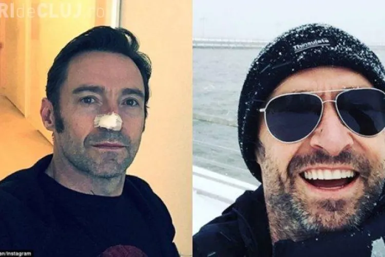 Hugh Jackman se luptă cu cancerul pentru a șasea oară