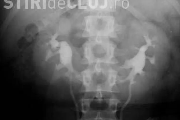 Își vinde un rinichi. Anunțul e online, iar prețul nu e mic 