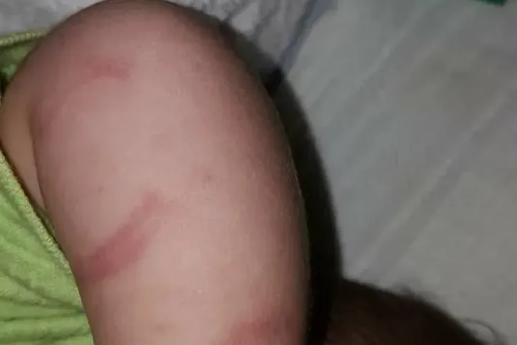 Medicii de la UPU Copii Cluj au învinețit un copil de 3 săptămâni. Intervenția era BANALĂ