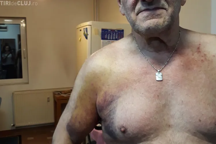 Protestatar: Jandarmii mi-au făcut baie cu gaze. Mi s-a dus un rând de piele - VIDEO