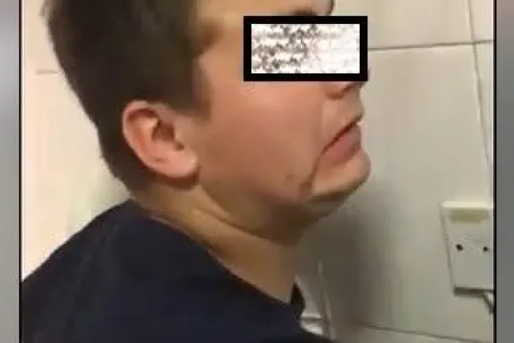 Cum arată doi tineri drogați cu Zombie. Efecte incredibile - VIDEO