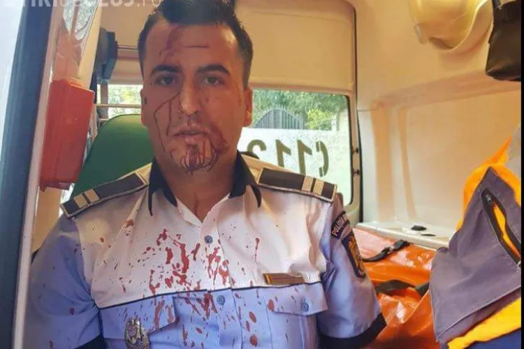 Tupeu de șofer! A bătut crunt un polițist care l-a urmărit în trafic