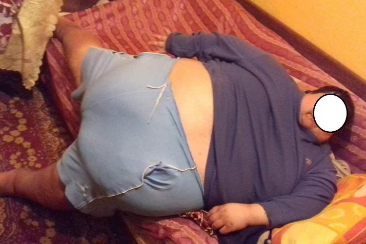 Tânărul de 200 de kg din Cluj, refuzat de spitale, a MURIT. Mama: Nimeni nu te ajută fără bani