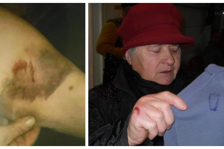 Cluj: O șoferiță de camion s-a luptat cu trei femei care îi intraseră în casă, să o jefuiască