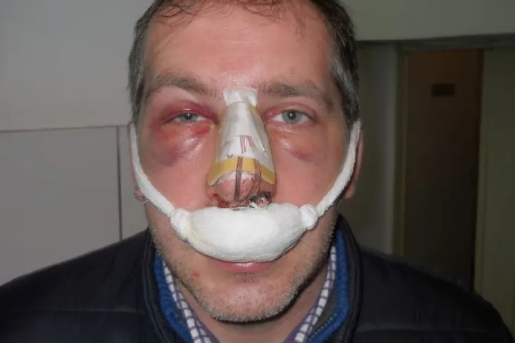 Taximetrist clujean, desfigurat în trafic de un alt șofer cu o lovitură fatală - FOTO