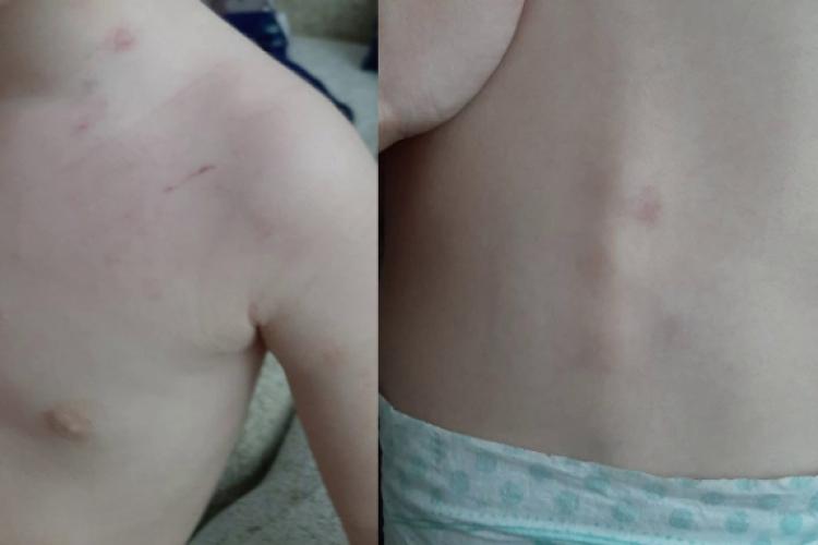 Cluj: Copil agresat în prima sa zi la creșă. Suspectă este asistenta creșei