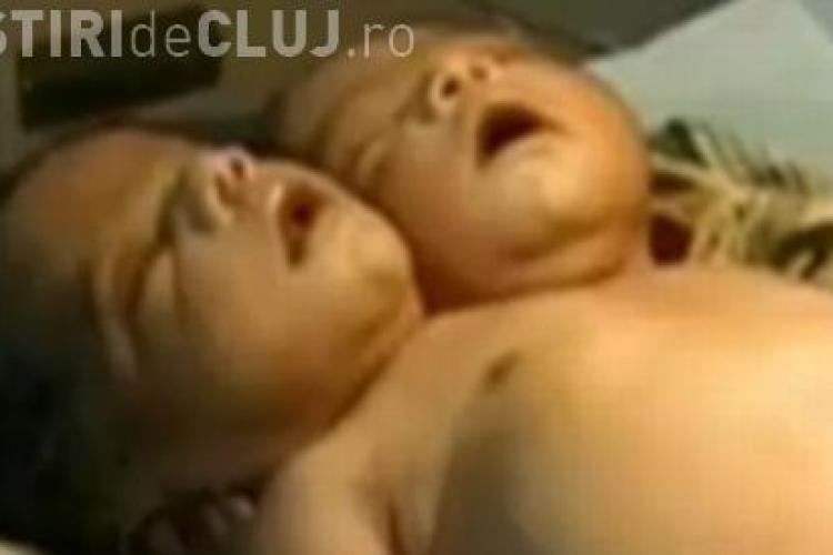 Copil cu doua capete, nascut in India - VEZI VIDEO