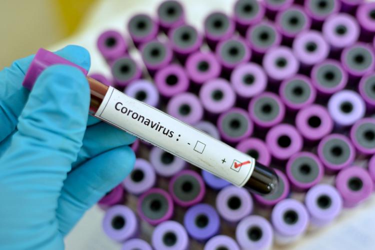 Alte cinci cazuri pozitive de coronavirus depistate de medicii din Cluj 