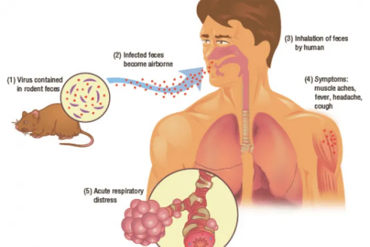 În China a apărut un caz de hantavirus, care este mai periculos ca și coronavirusul 