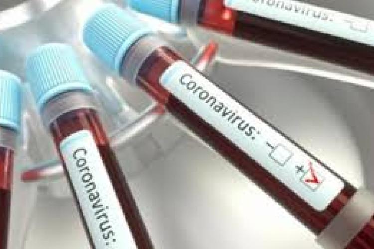 Situația cazurilor de coronavirus pe județe - 19 aprilie 