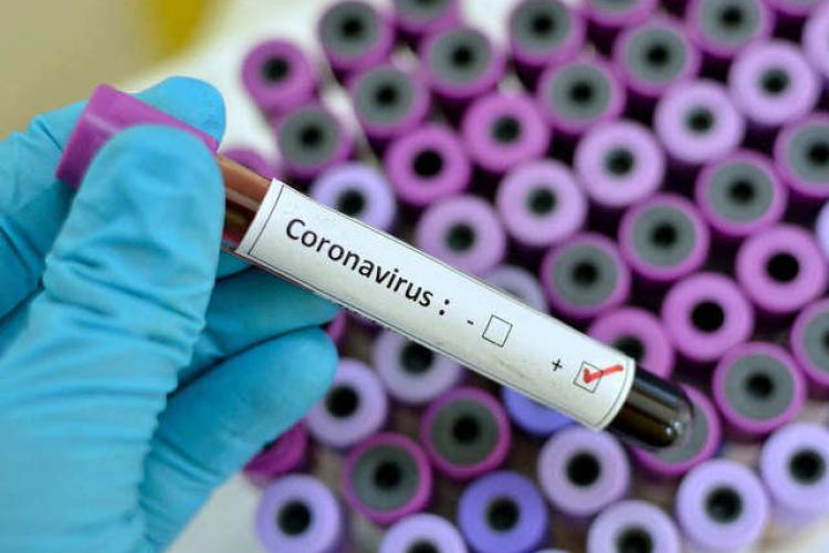 Recomandări de protecție pentru pacienții cronici în contextul pandemiei cu virusul SARS-CoV 2 