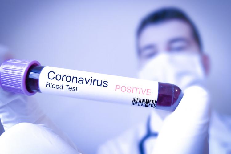 Peste 320 de cazuri noi de coronavirus în ultimele 24 de ore. Câte persoane s-au vindecat până acum