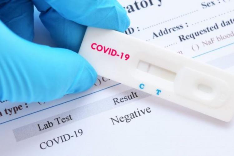 A apărut primul test care îți arată cât de imun ești la coronavirus 