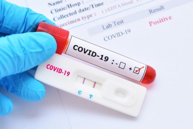 Test rapid pentru coronavirus, care dă rezultatul în 15 minute