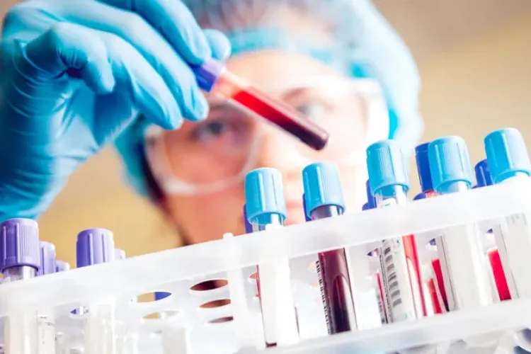 Test rapid PCR produs în Ungaria pentru depistarea Covid-19