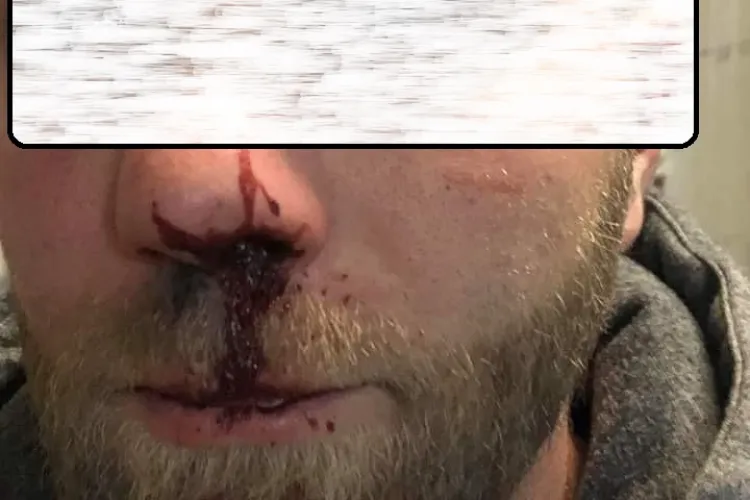 Bărbat bătut de interlopi, în parcare la Mega Image, pe strada Dorobanților - FOTO