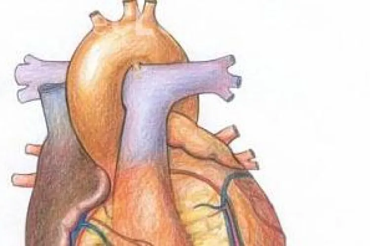 Transplant de inima artificiala la Cluj!