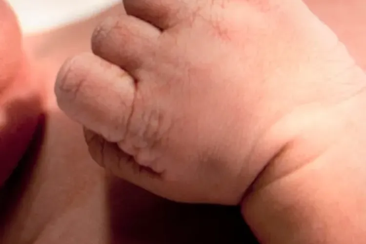 Bebeluș cu două capete, născut în București. Din păcate, copilul a murit    