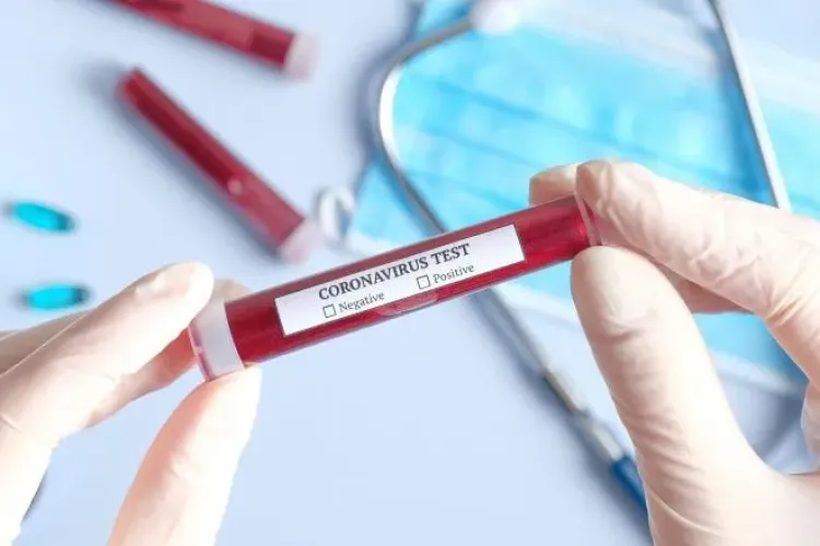 2.745 de cazuri de COVID-19 și aproape 100 de DECESE în ultimele 24 de ore