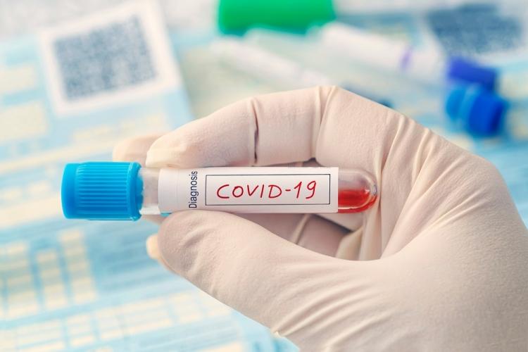 2.676 de cazuri noi de infectări cu COVID-19 în România