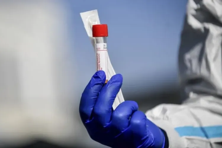 SCADE numărul cazurilor de COVID-19 în România? Numărul deceselor a crescut