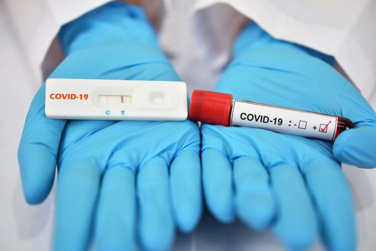  Cât costă testele Covid-19, după un an de pandemie 